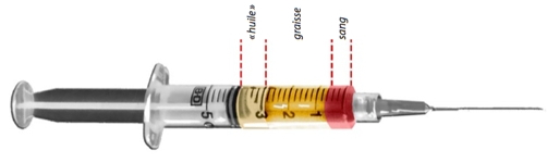 lipostructure, lipostructure visage, lipostructure cernes, lipostructure paupières, lipostructure lèvres, lifting, lipostructure tarif, prix lipostructure, lipostructure lyon, lipostructure lausanne, torossian, lipostructure rides, lipostructure résultat