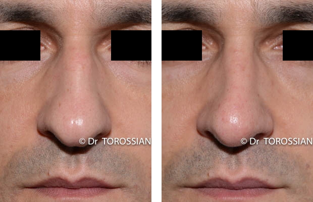 profiloplastie lyon, profiloplastie lausanne, chirurgie du nez lyon, chirurgie du nez lausanne , chirurgien rhinoplastie lyon, chirurgien rhinoplastie lausanne, meilleur chirurgien rhinoplastie lyon, meilleur chirurgien rhinoplastie lausanne, prix rhinoplastie lyon, prix rhinoplastie lausanne, rhinoplastie lyon, rhinoplastie lausanne, rhinoplastie prix lyon, rhinoplastie prix lausanne, spécialiste rhinoplastie lyon, spécialiste rhinoplastie lausanne, genioplastie lyon, genioplastie lausanne, chirurgie du visage lyon, chirurgie du visage lausanne, chirurgie esthetique visage lyon, chirurgie esthetique visage lausanne, chirurgie visage lyon, chirurgie visage lausanne, spécialiste visage lyon, bon chirurgien esthetique lyon, bon chirurgien esthetique lausanne, cabinet esthetique lyon, cabinet esthetique lausanne, chirurgie plastique lyon, chirurgie plastique lausanne, chirurgien esthetique lyon, chirurgien esthetique lausanne, chirurgien plasticien lyon, chirurgien plasticien lausanne, chirurgien plastique lyon, chirurgien plastique lausanne, clinique chirurgie esthétique lyon, clinique chirurgie esthétique l lausanne, meilleur chirurgien esthetique lyon, meilleur chirurgien esthetique lausanne, tarif chirurgie esthetique lyon, tarif chirurgie esthetique lausanne, 