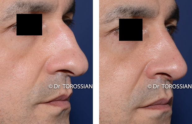 profiloplastie lyon, profiloplastie lausanne, chirurgie du nez lyon, chirurgie du nez lausanne , chirurgien rhinoplastie lyon, chirurgien rhinoplastie lausanne, meilleur chirurgien rhinoplastie lyon, meilleur chirurgien rhinoplastie lausanne, prix rhinoplastie lyon, prix rhinoplastie lausanne, rhinoplastie lyon, rhinoplastie lausanne, rhinoplastie prix lyon, rhinoplastie prix lausanne, spécialiste rhinoplastie lyon, spécialiste rhinoplastie lausanne, genioplastie lyon, genioplastie lausanne, chirurgie du visage lyon, chirurgie du visage lausanne, chirurgie esthetique visage lyon, chirurgie esthetique visage lausanne, chirurgie visage lyon, chirurgie visage lausanne, spécialiste visage lyon, bon chirurgien esthetique lyon, bon chirurgien esthetique lausanne, cabinet esthetique lyon, cabinet esthetique lausanne, chirurgie plastique lyon, chirurgie plastique lausanne, chirurgien esthetique lyon, chirurgien esthetique lausanne, chirurgien plasticien lyon, chirurgien plasticien lausanne, chirurgien plastique lyon, chirurgien plastique lausanne, clinique chirurgie esthétique lyon, clinique chirurgie esthétique l lausanne, meilleur chirurgien esthetique lyon, meilleur chirurgien esthetique lausanne, tarif chirurgie esthetique lyon, tarif chirurgie esthetique lausanne, 