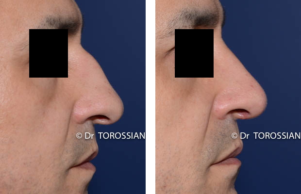 profiloplastie lyon, profiloplastie lausanne, chirurgie du nez lyon, chirurgie du nez lausanne , chirurgien rhinoplastie lyon, chirurgien rhinoplastie lausanne, meilleur chirurgien rhinoplastie lyon, meilleur chirurgien rhinoplastie lausanne, prix rhinoplastie lyon, prix rhinoplastie lausanne, rhinoplastie lyon, rhinoplastie lausanne, rhinoplastie prix lyon, rhinoplastie prix lausanne, spécialiste rhinoplastie lyon, spécialiste rhinoplastie lausanne, genioplastie lyon, genioplastie lausanne, chirurgie du visage lyon, chirurgie du visage lausanne, chirurgie esthetique visage lyon, chirurgie esthetique visage lausanne, chirurgie visage lyon, chirurgie visage lausanne, spécialiste visage lyon, bon chirurgien esthetique lyon, bon chirurgien esthetique lausanne, cabinet esthetique lyon, cabinet esthetique lausanne, chirurgie plastique lyon, chirurgie plastique lausanne, chirurgien esthetique lyon, chirurgien esthetique lausanne, chirurgien plasticien lyon, chirurgien plasticien lausanne, chirurgien plastique lyon, chirurgien plastique lausanne, clinique chirurgie esthétique lyon, clinique chirurgie esthétique l lausanne, meilleur chirurgien esthetique lyon, meilleur chirurgien esthetique lausanne, tarif chirurgie esthetique lyon, tarif chirurgie esthetique lausanne, 